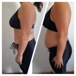 کلینیک لاغری دکتر مرضیه استاد | بهترین کلینیک لاغری بندرعباس